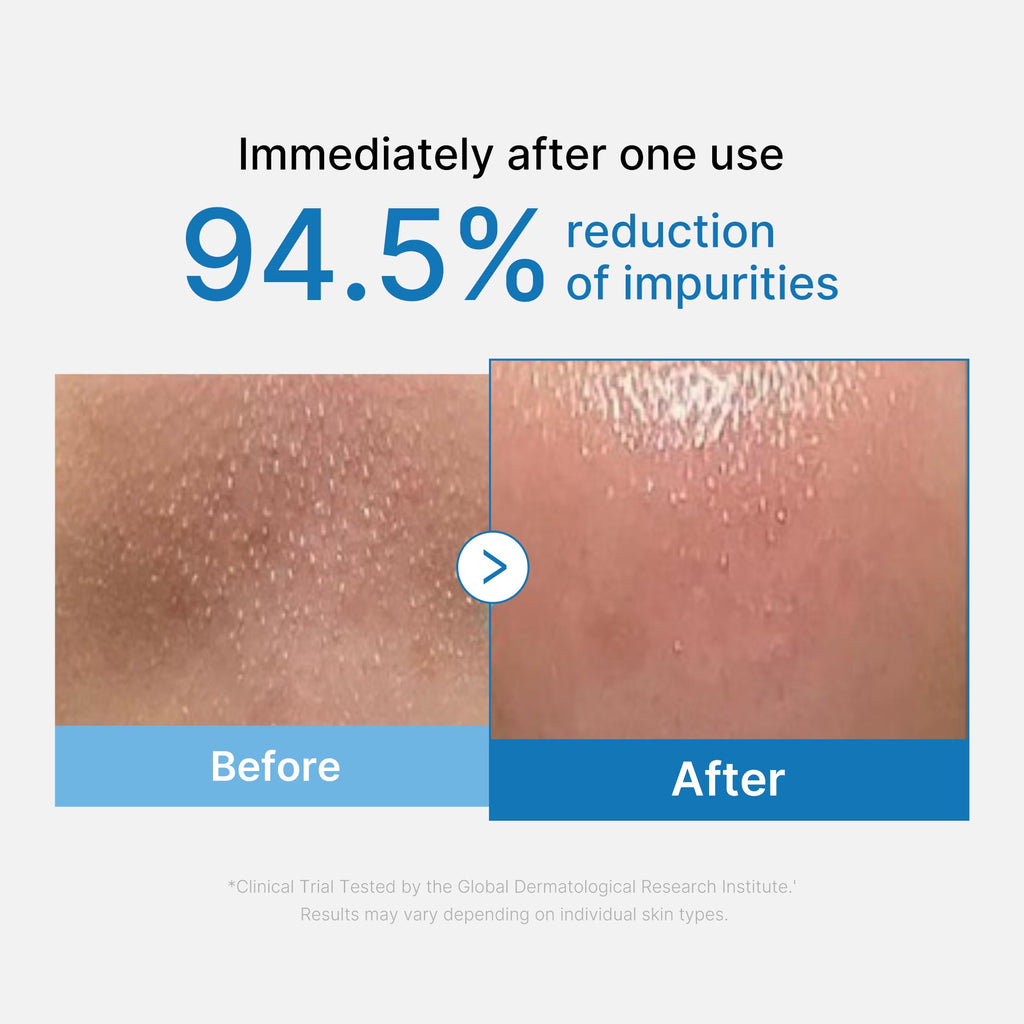 Zero Pore Blackhead Deep Cleansing Oil J1