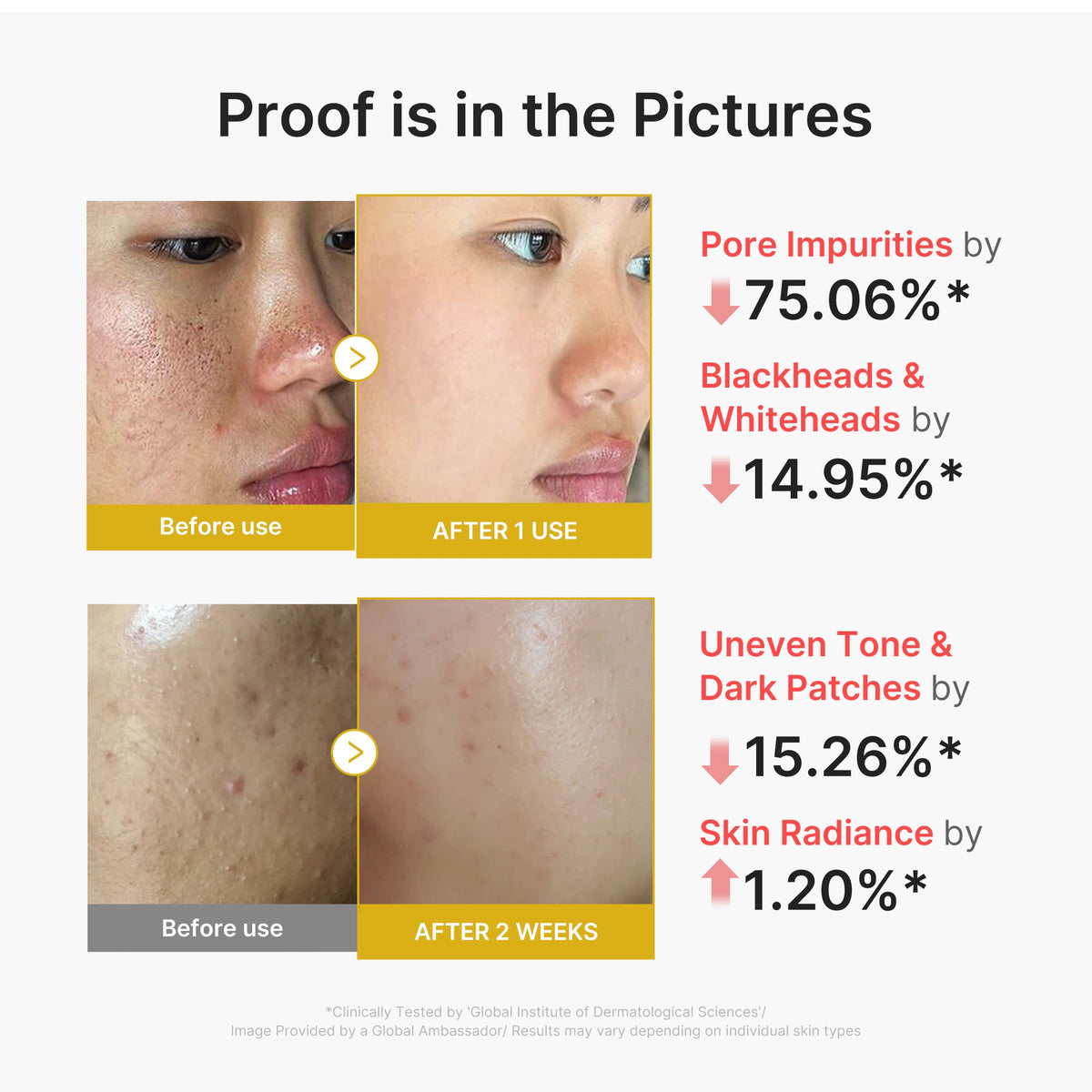 Kojic Acid Turmeric Peel Shot S1