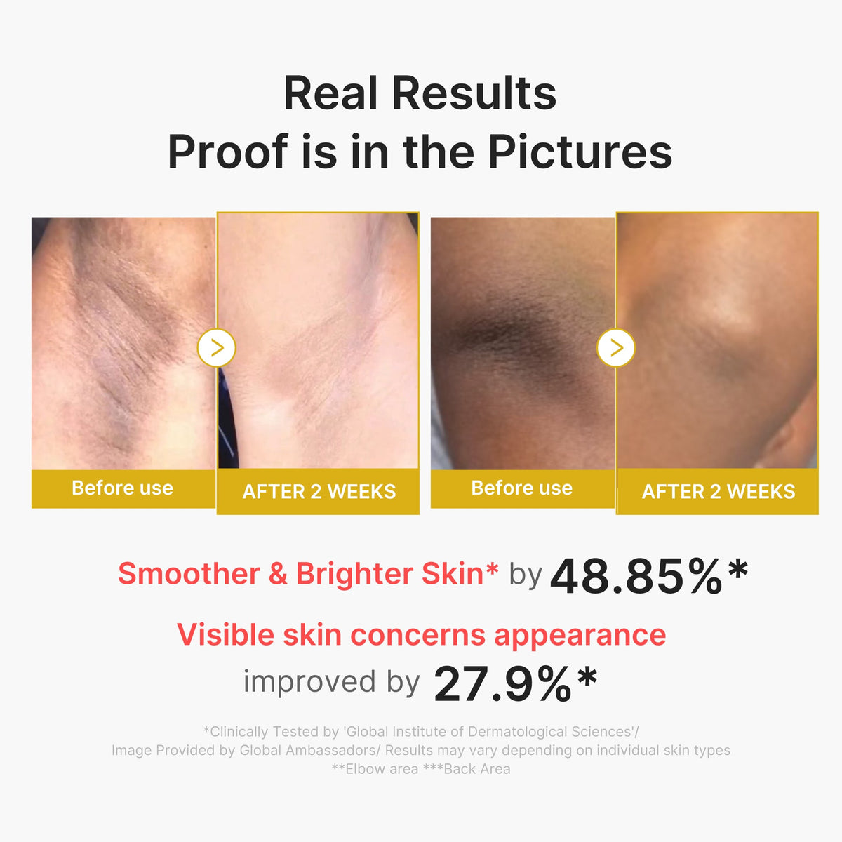 Kojic Acid Turmeric Body Peel Shot G4