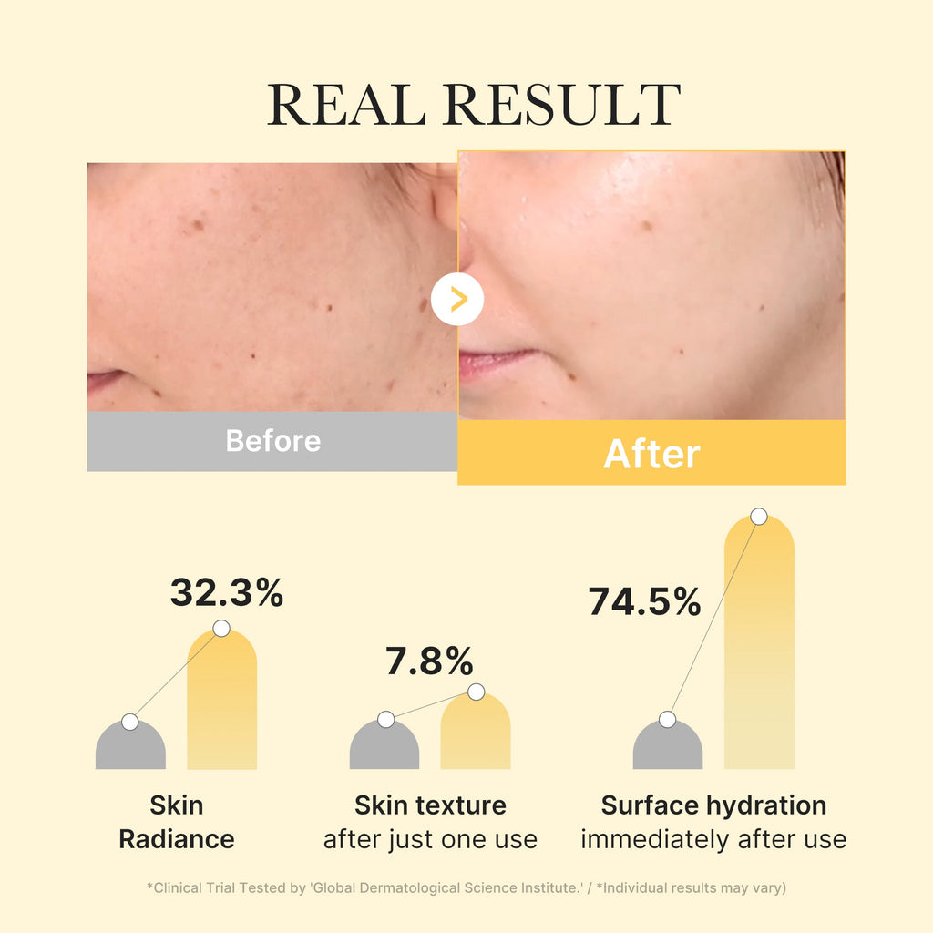 Kojic Acid Turmeric Gold Jelly Gel Mask Z2