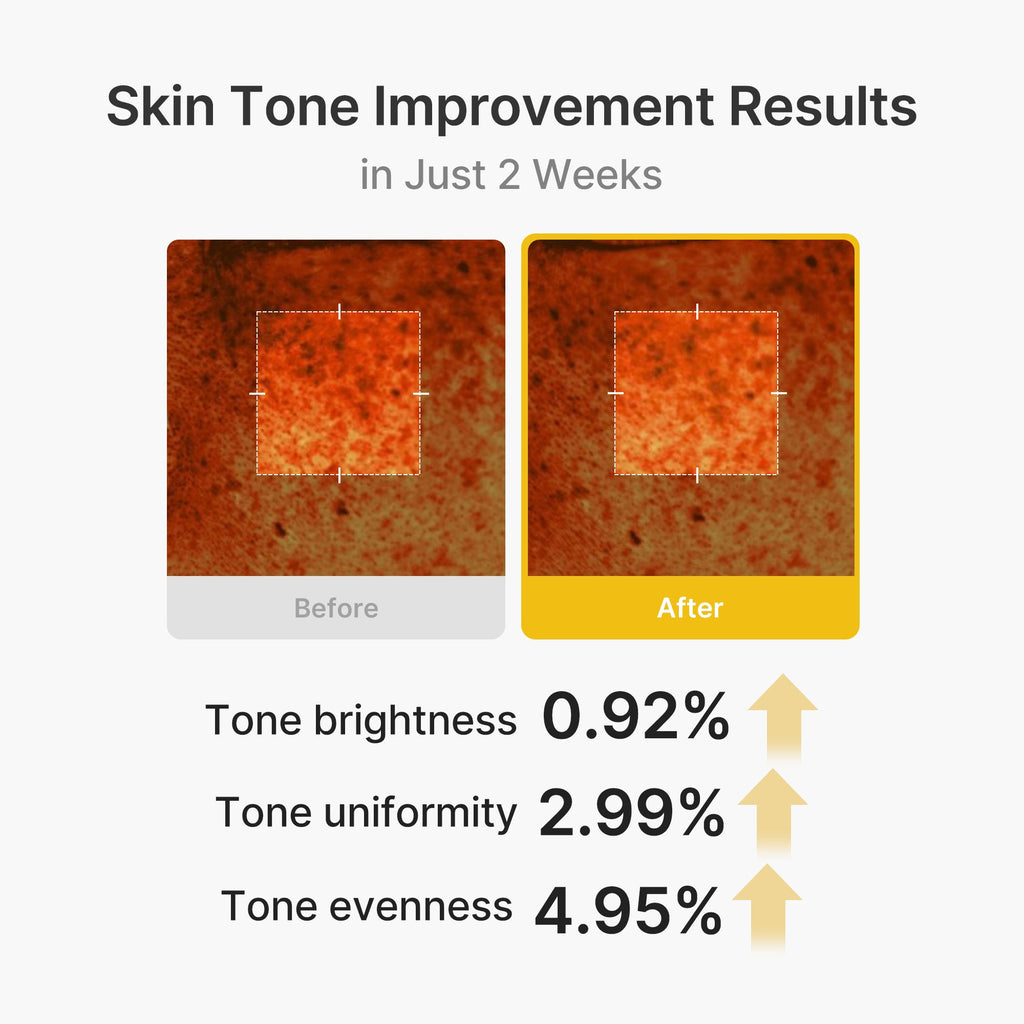 Kojic Acid Turmeric Vita Capsule Cream K2