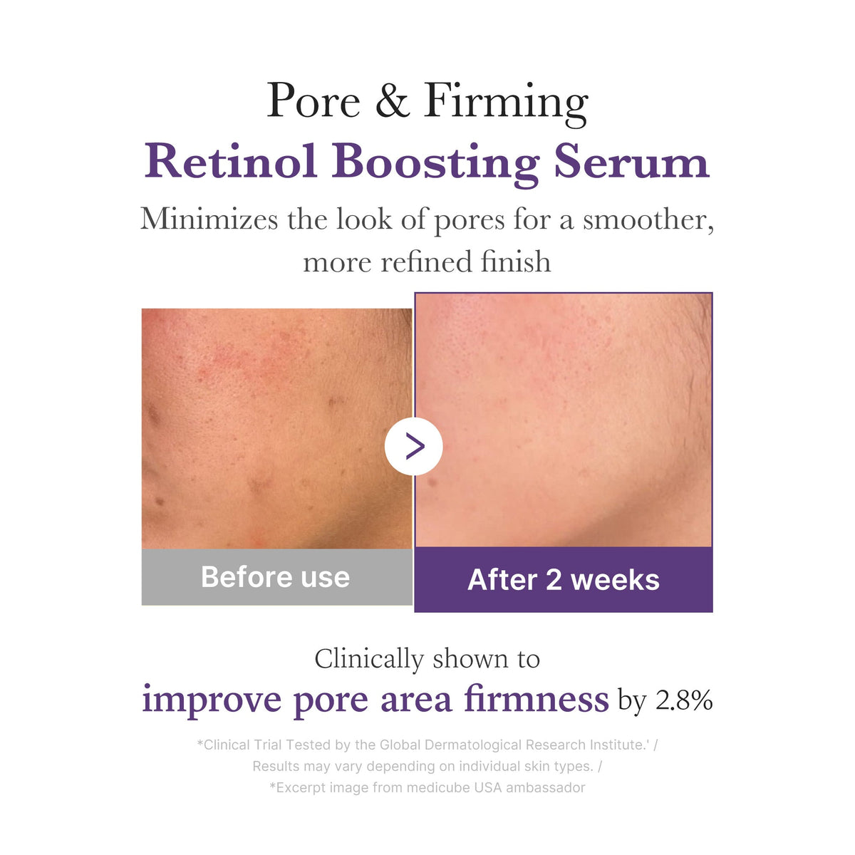 Retinol NMN Boosting Serum X1