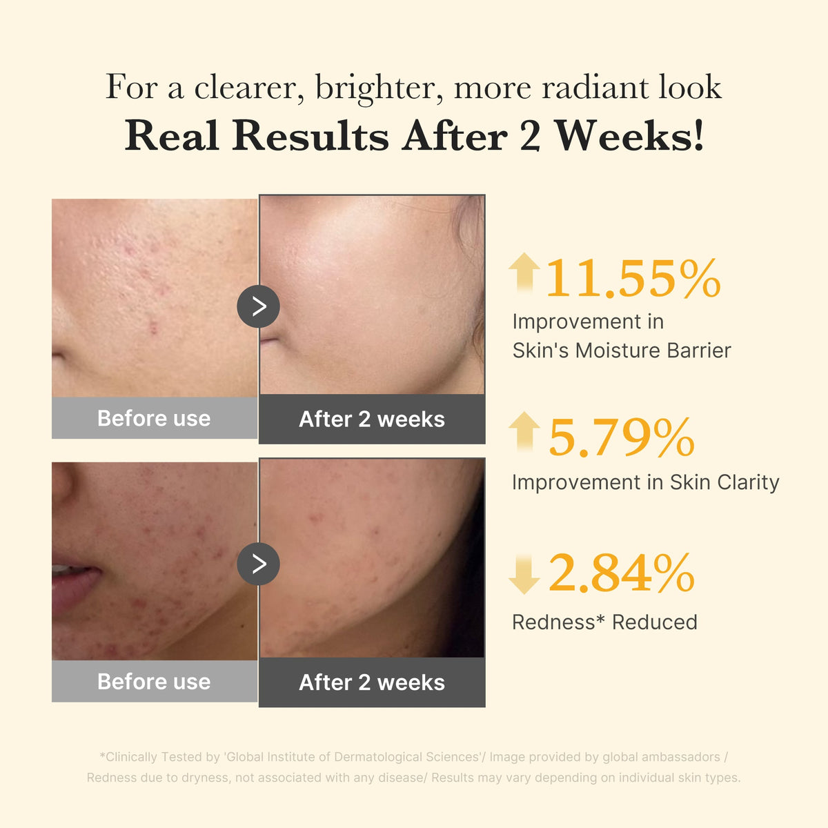 Kojic Acid Turmeric Capsule Serum V5