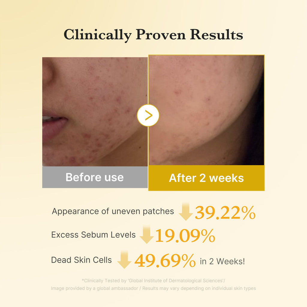 Kojic Acid Tumeric Toner Pad N2