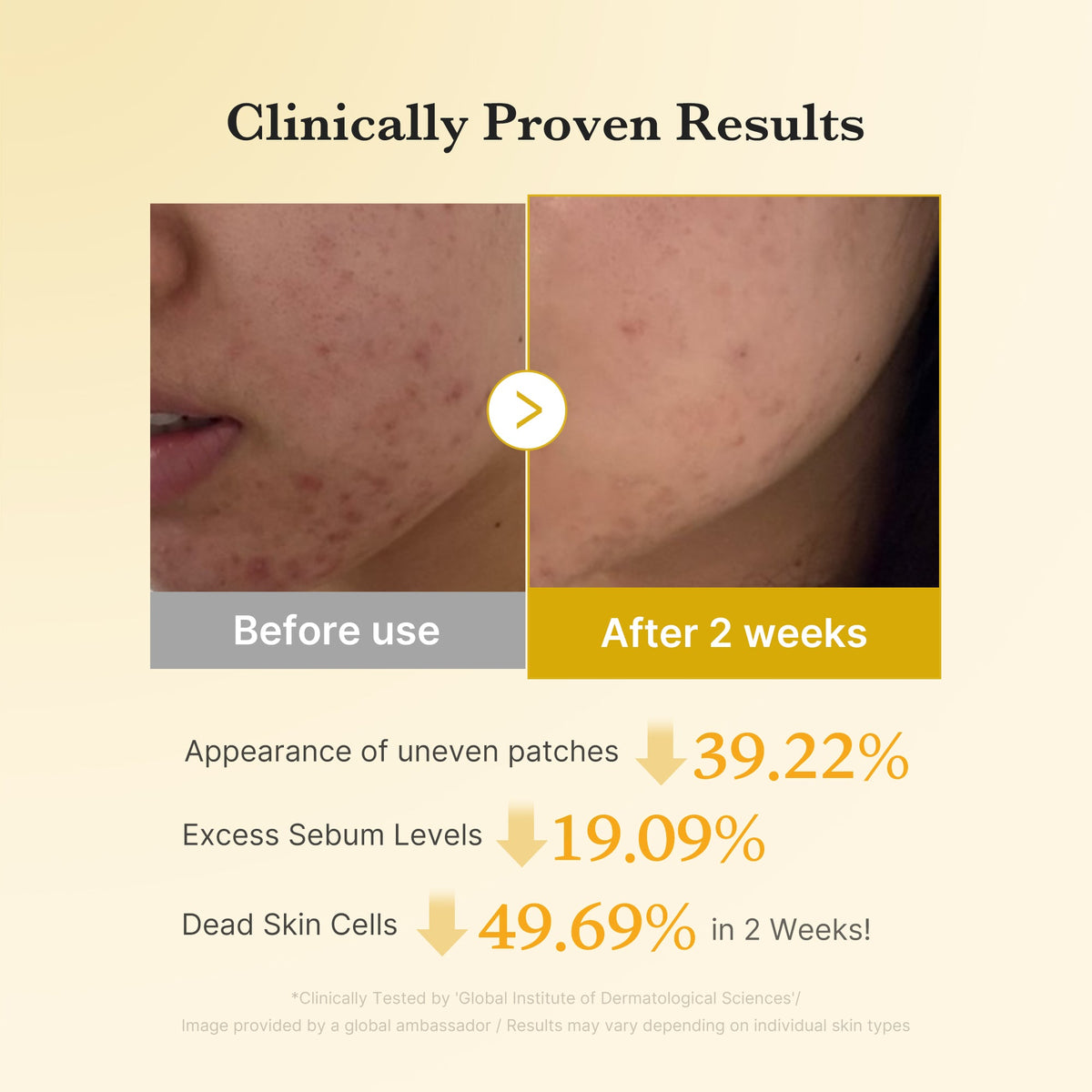 Kojic Acid Tumeric Toner Pad N2