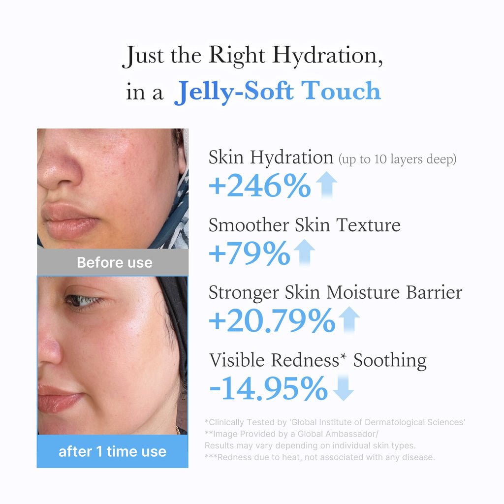 Hyaluronic Ceramide Moisturizing Jelly Cream Z6