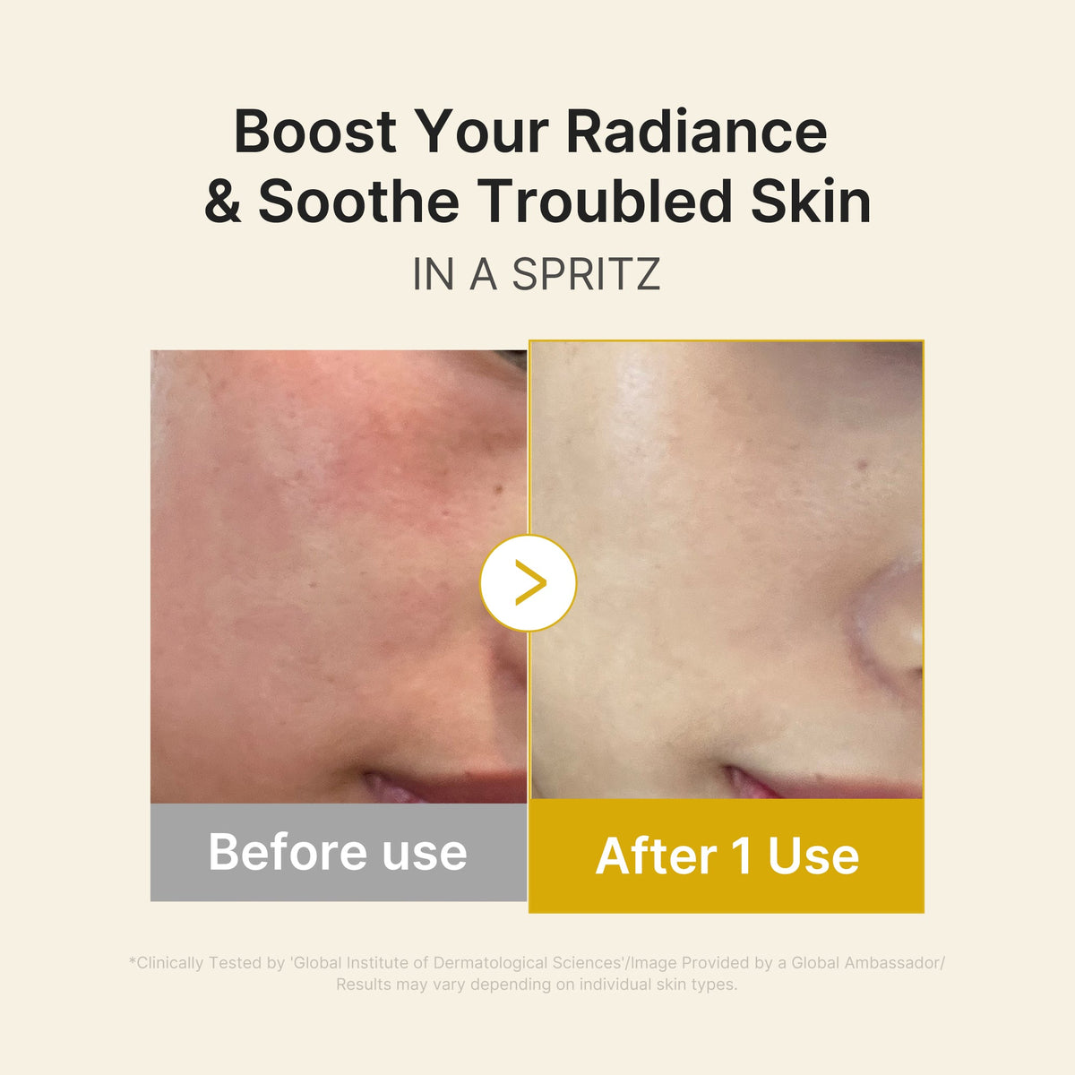 Kojic Acid Turmeric Vitamin Gold Jelly Mist Serum R0