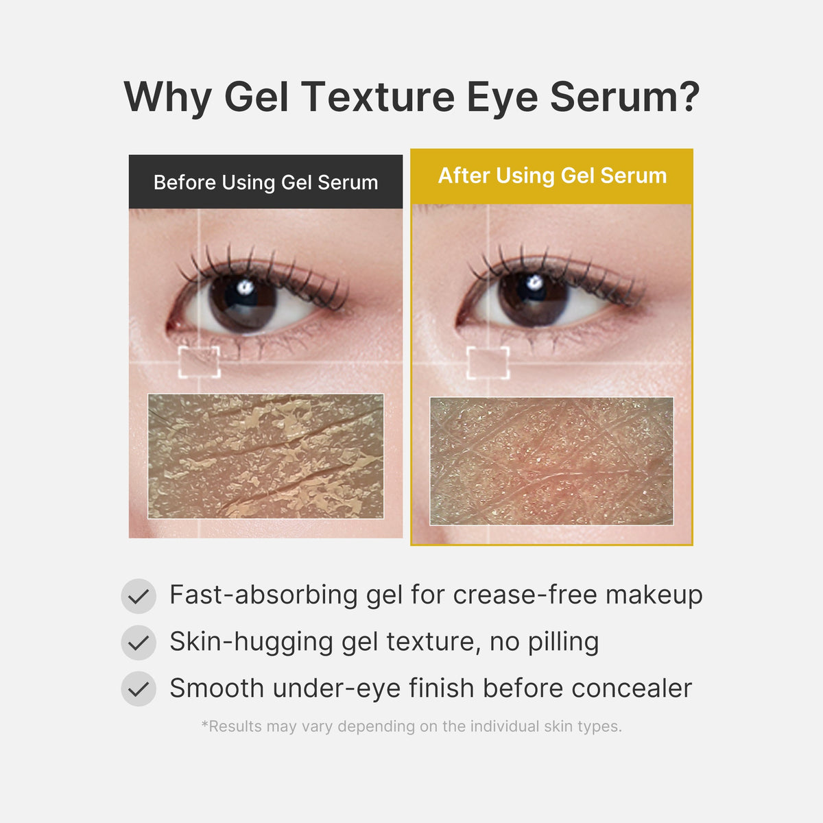 Kojic Acid Tumeric Eye Gel Serum Z6