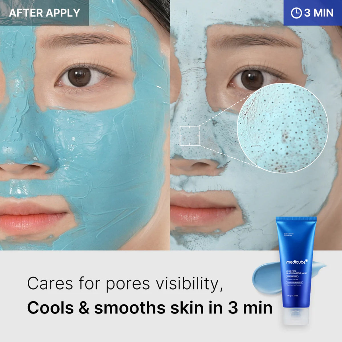 Zero Pore Blackhead Mud Mask F2