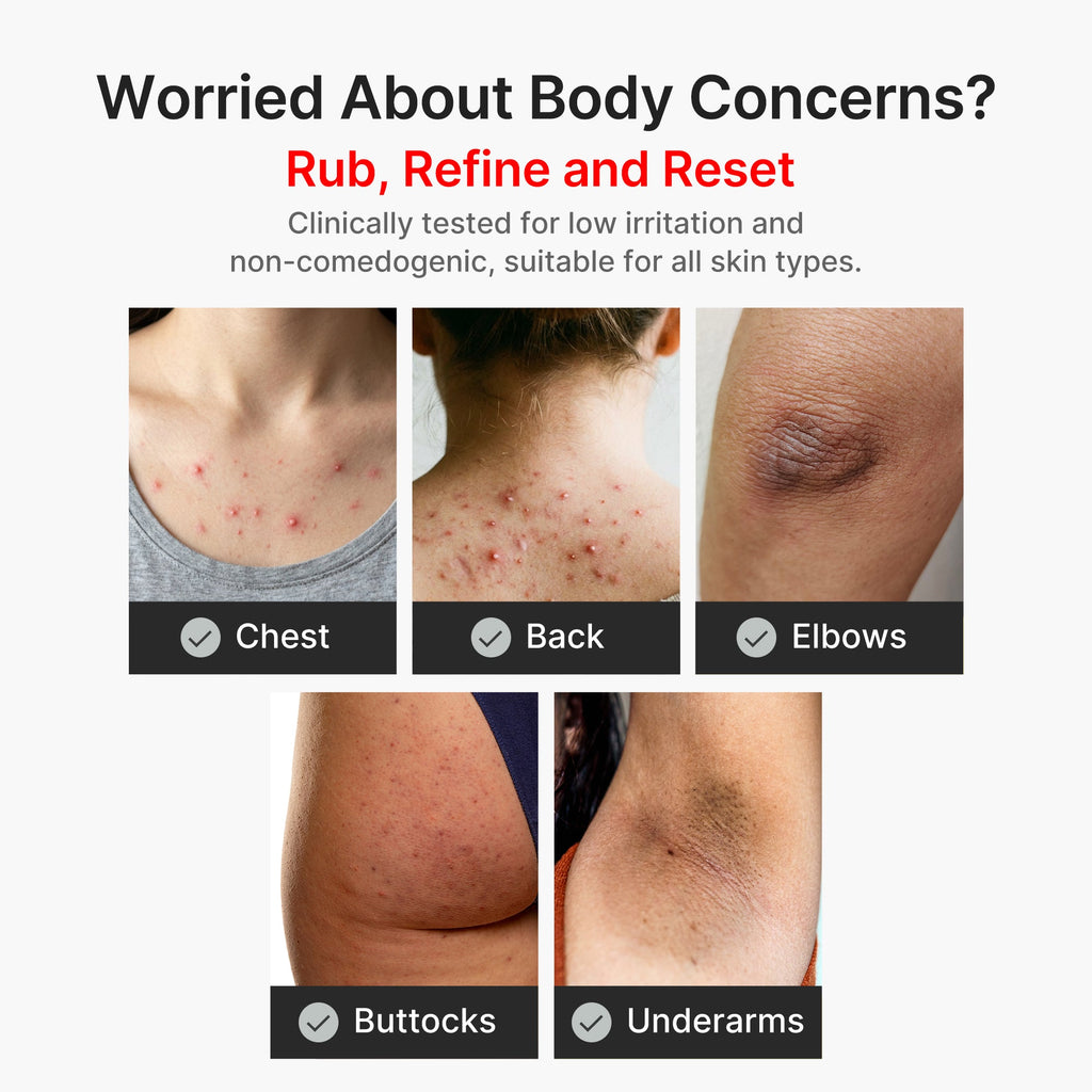 Kojic Acid Turmeric Body Peel Shot G4