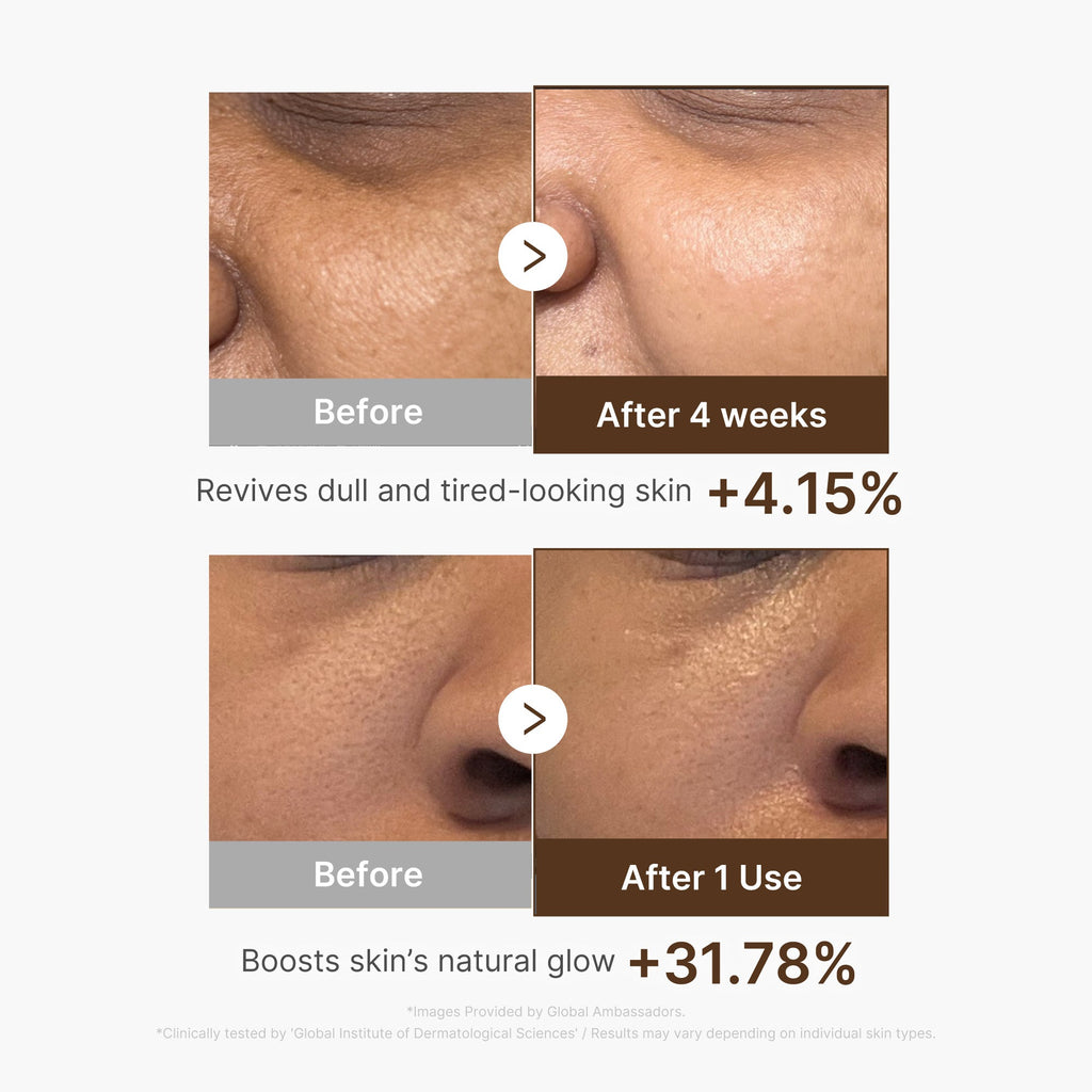 Deep Vitamin C Capsule Serum Z4
