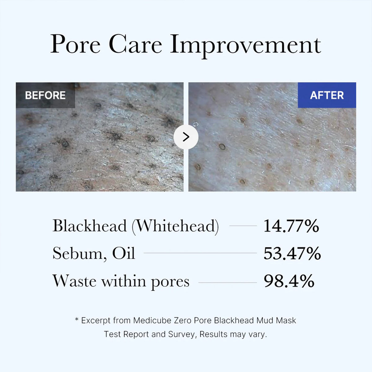 Zero Pore Blackhead Mud Mask F2