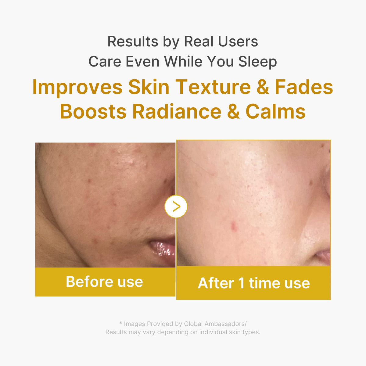 Kojic Acid Turmeric Overnight Wrapping Mask E0