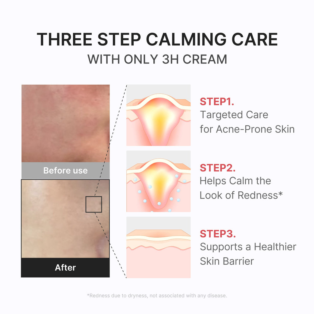 3H Daily Relief Cream L5
