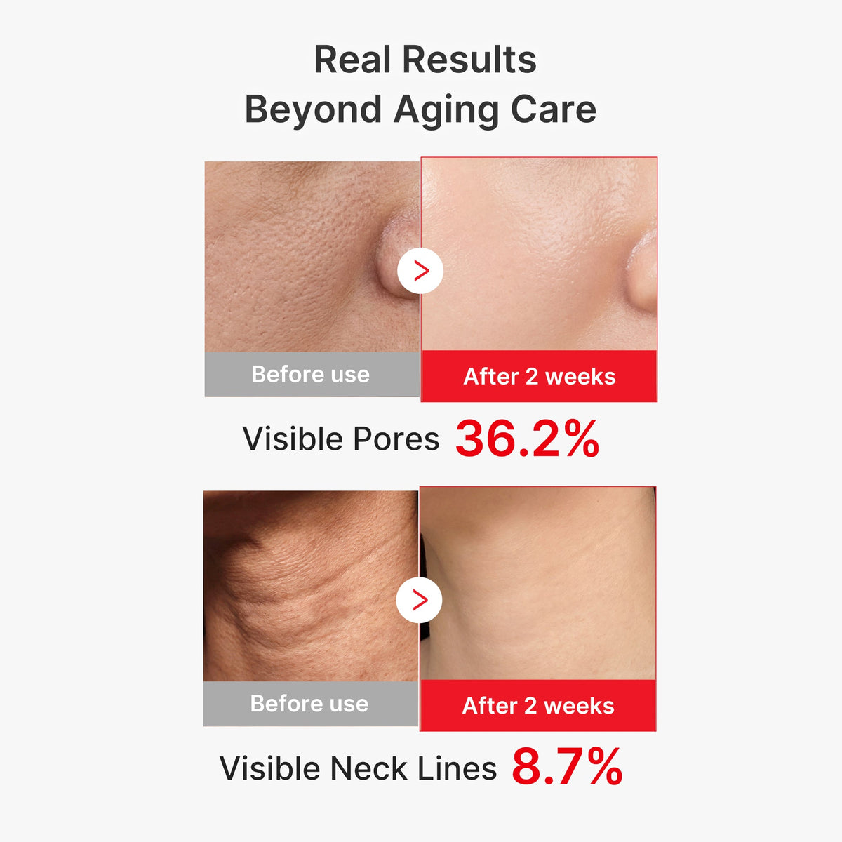 EGF NAD+ Firming Serum X6