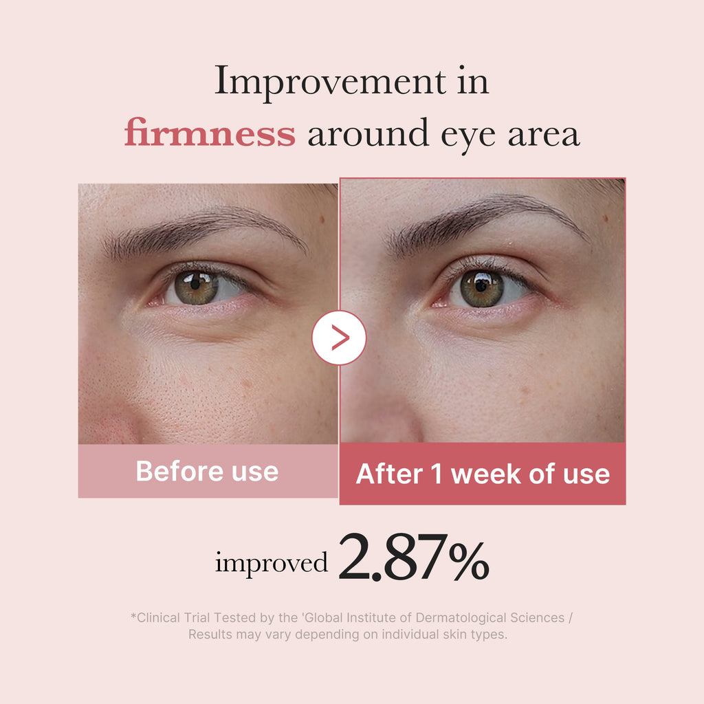 PDRN Pink Peptide Eye Cream J5
