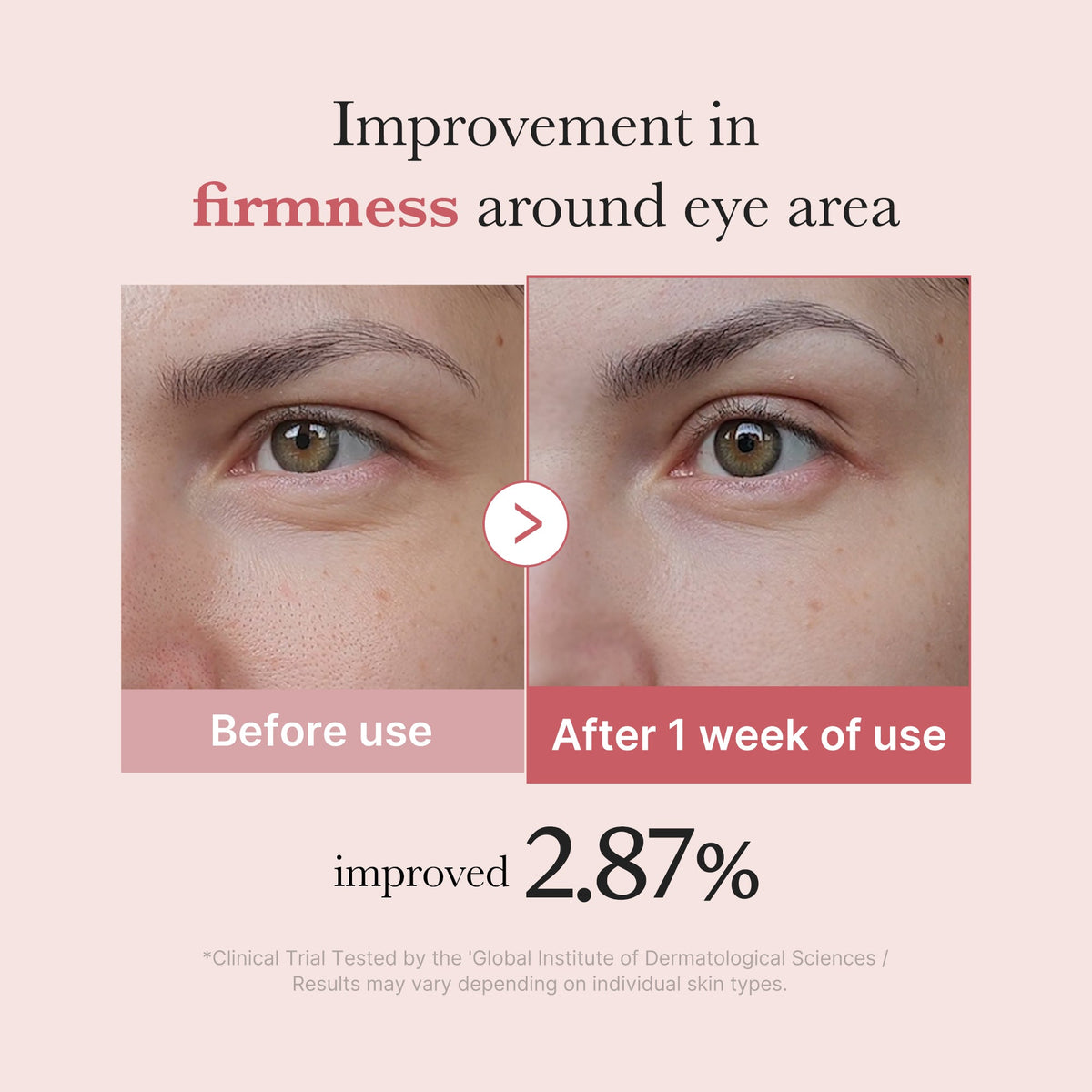 PDRN Pink Peptide Eye Cream J5