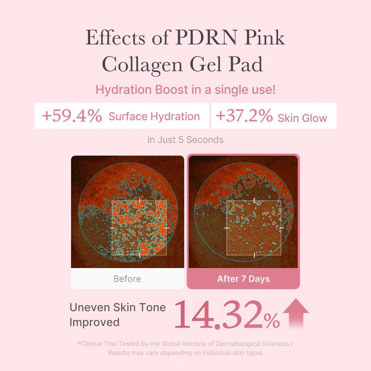 PDRN Pink Collagen Gel Toner Pad T4