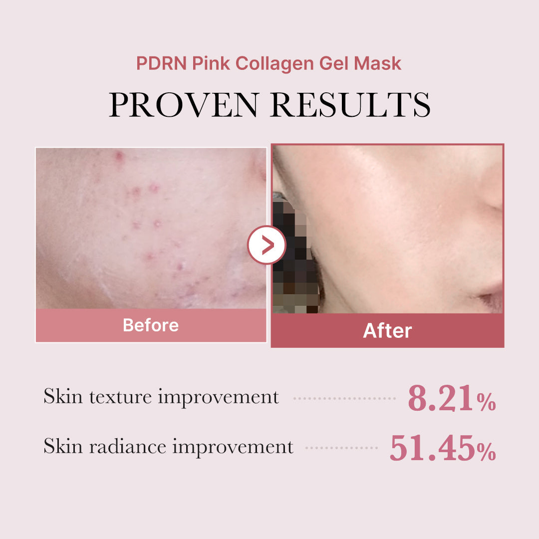PDRN Pink Glow Full Set U8