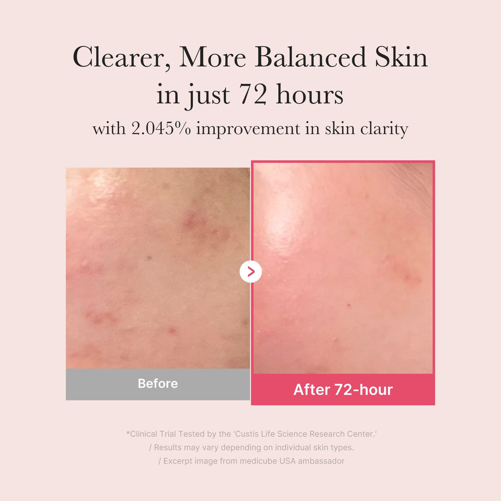 TXA Niacinamide Serum A9